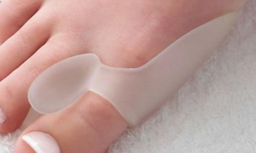 엄지 발가락의 건막류에 대한 효과적인 치료법